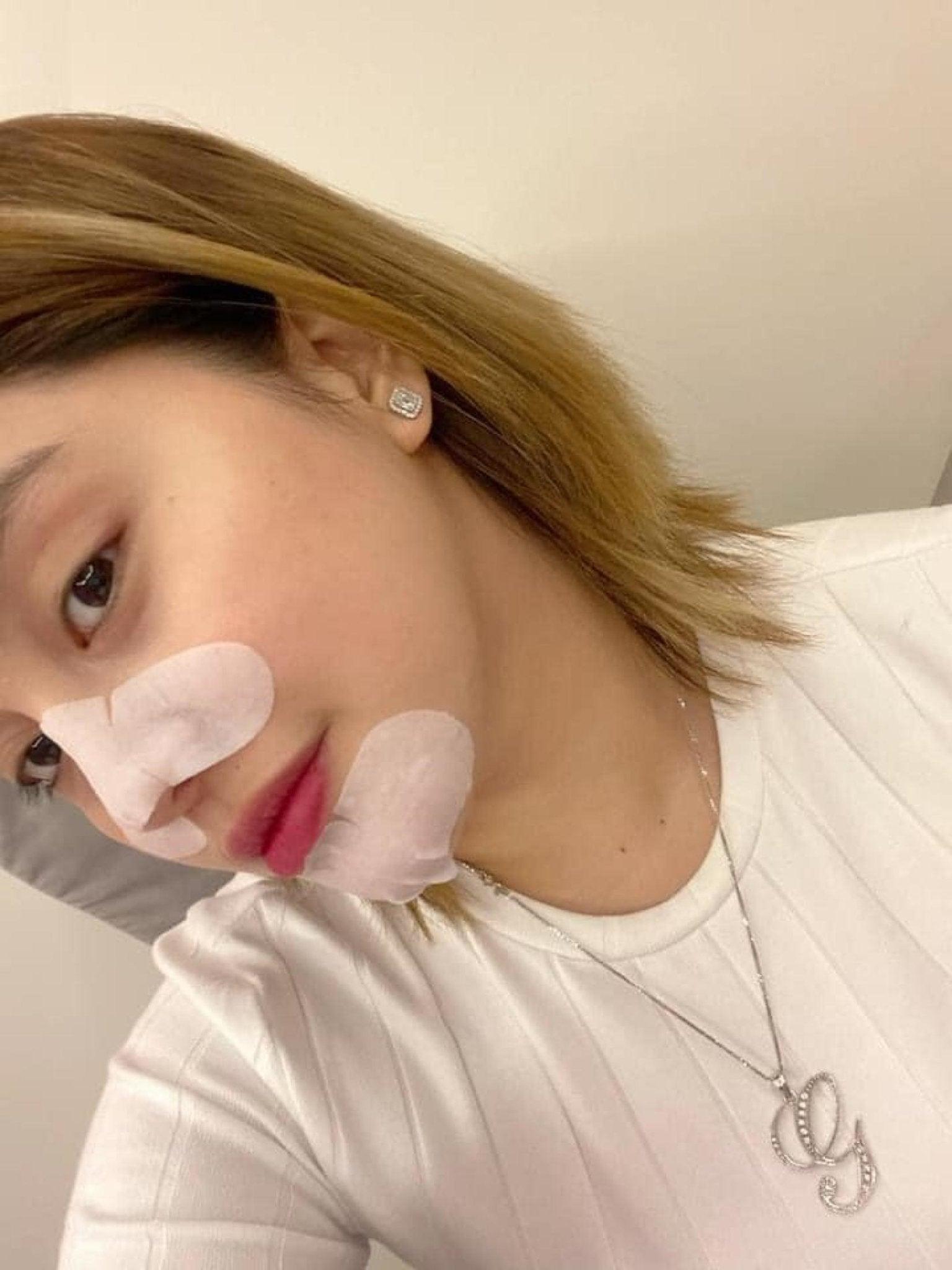 Brilliant 3 Step Blackheads Removal Nose Strips - Pinoyhyper