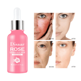 Disaar Repair & Brighten Multi Function Essence Rose Face Serum - 30ml - Pinoyhyper