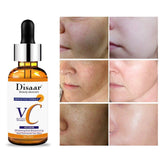 Disaar VC Face Serum - 30ml - Pinoyhyper