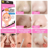 Disunie Removes Blackhead Nose Mask - 10Pcs - Pinoyhyper