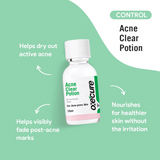 Oxecure Acne Clear Potion - 15ml