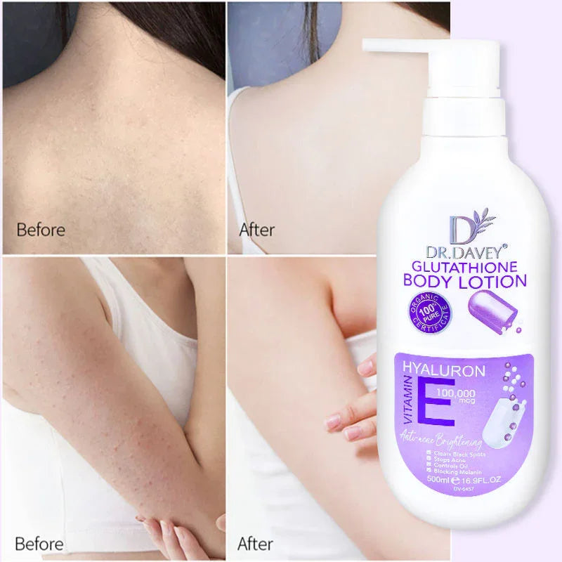 Dr. Davey Glutathione Body Lotion - 500ml