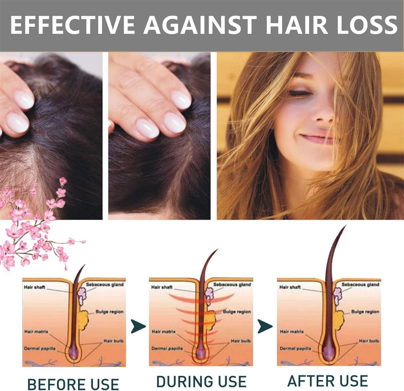 Maxfit Hair Growth Sakura Japanese Conditioner - 300ml