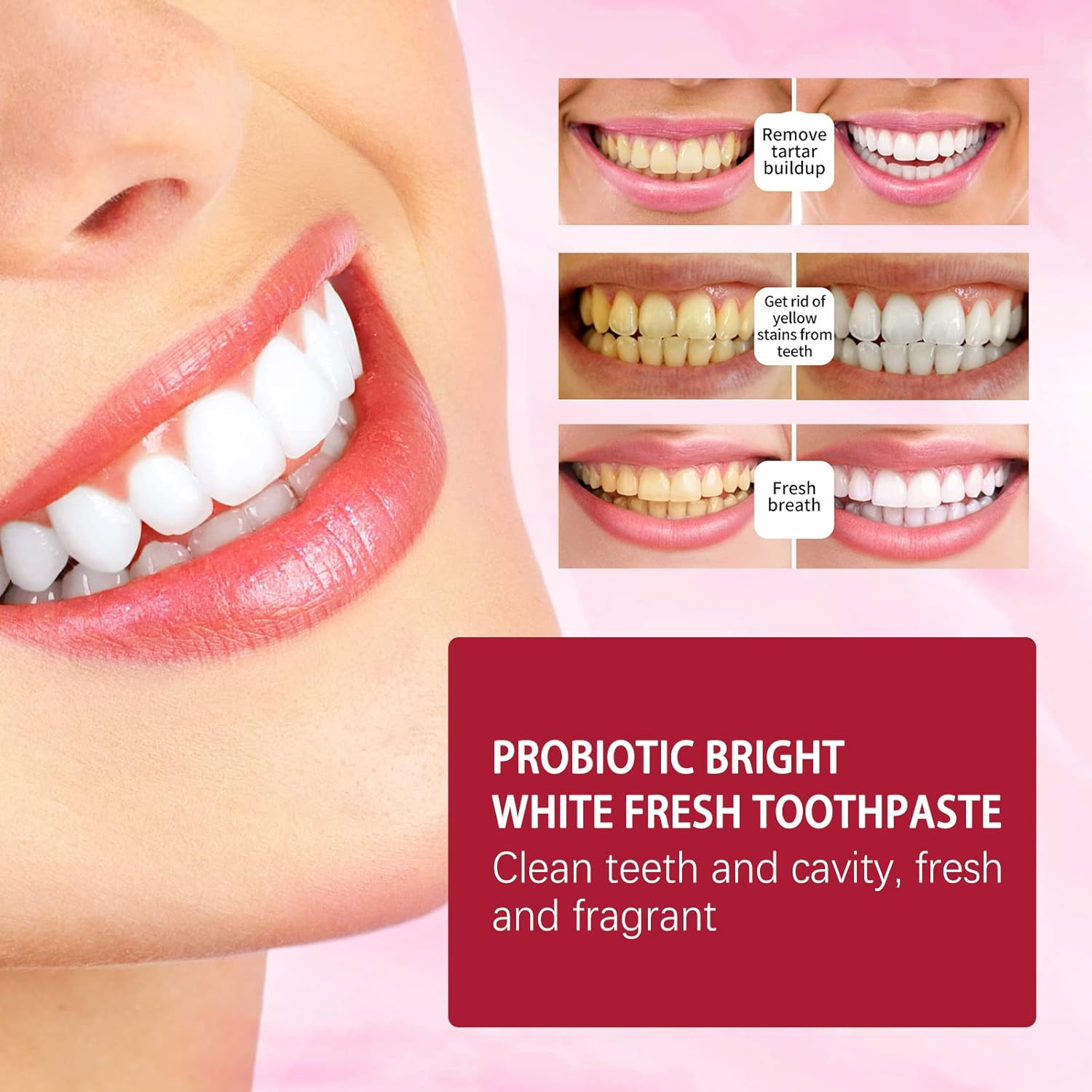 EELHOE SP-4 Probiotic Bright White Fresh Toothpaste - 120g