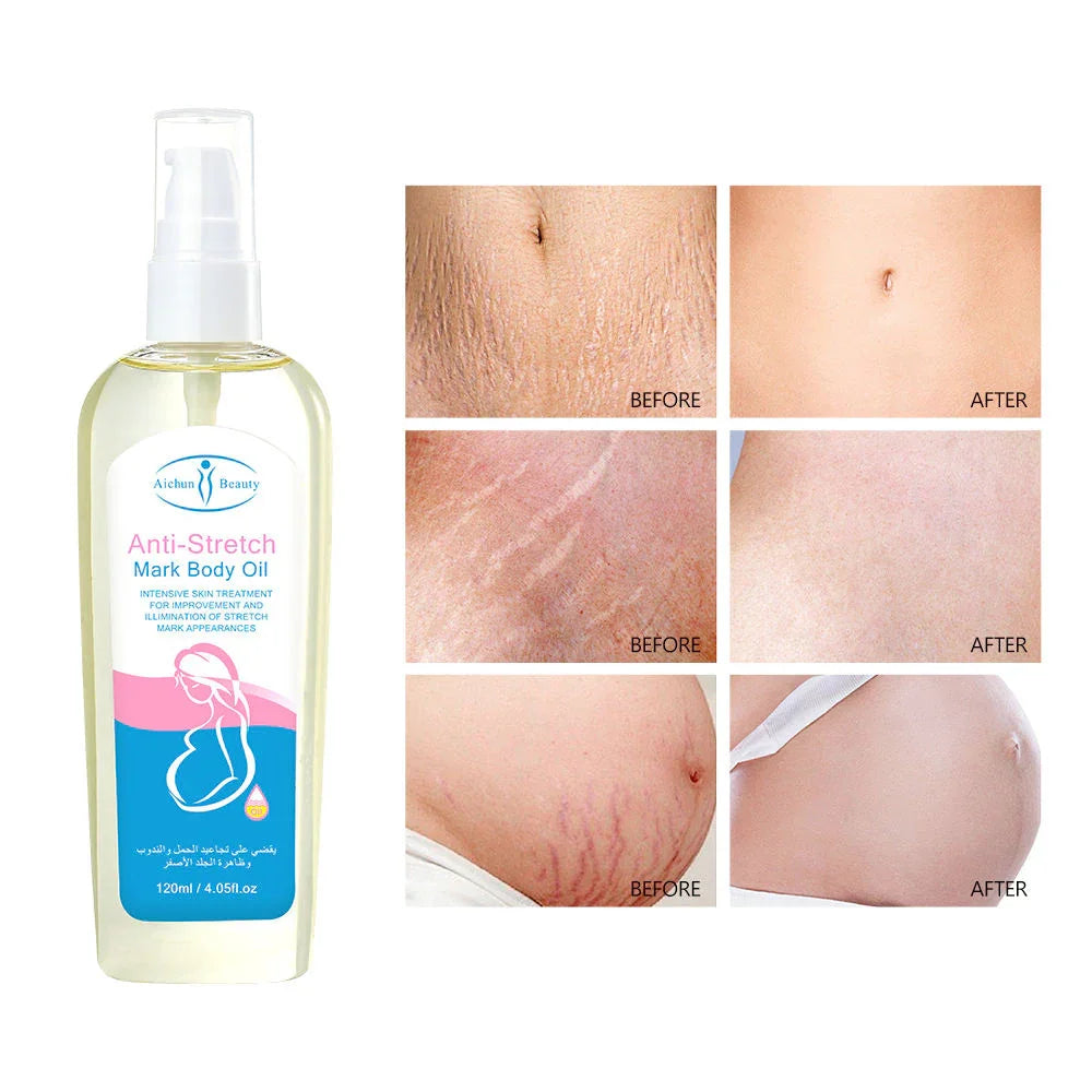 Aichun Beauty Anti-Stretch Mark Body Oil - 120ml