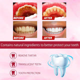 EELHOE SP-4 Probiotic Bright White Fresh Toothpaste - 120g