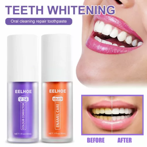 EELHOE V34 Colour Corrector + NH pro Enamel Care Set - 30ml × 2 Pcs