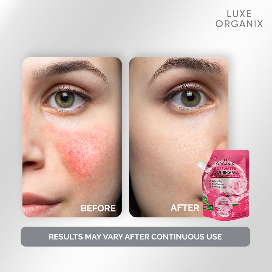 Luxe Organix Rosewater Soothing Gel - 100ml