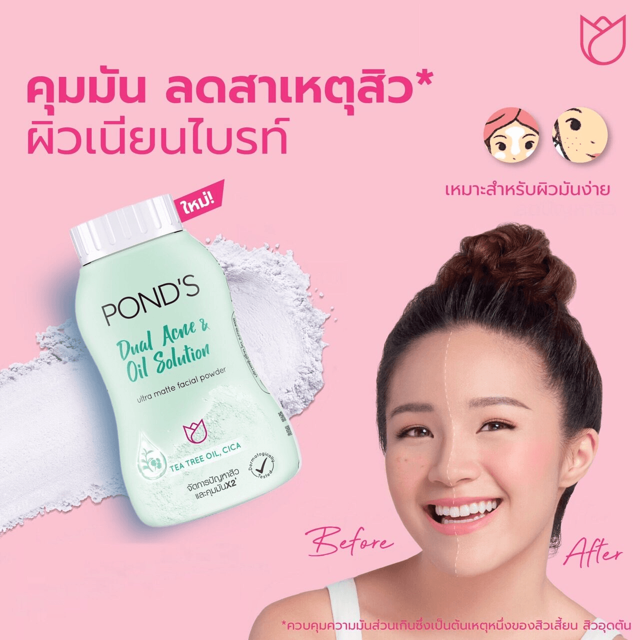 Pond's Dual Acne & Oil Solution Facial Powder - 50g