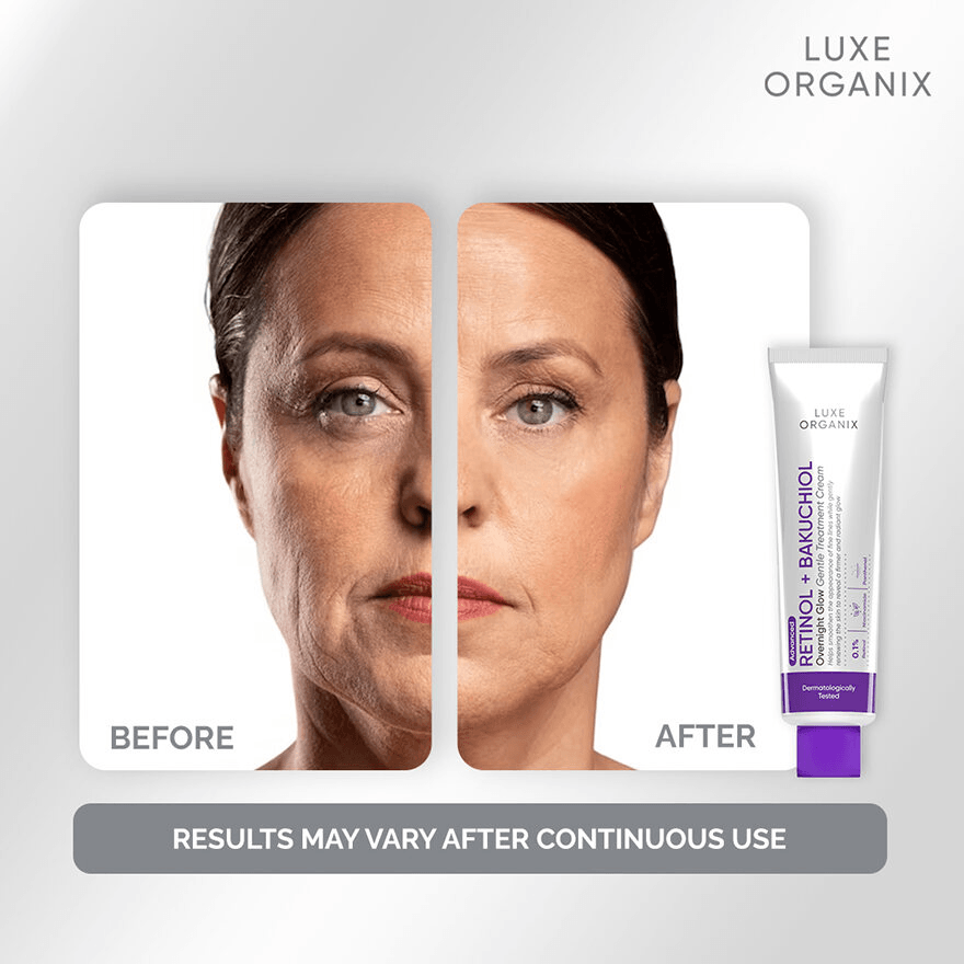 Luxe Organix Retinol + Bakuchiol Overnight Glow Gentle Treatment Cream - 30g