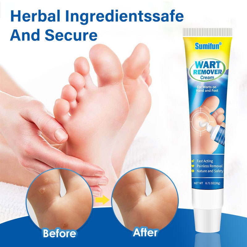 Sumifun Wart Remover Cream - 20g
