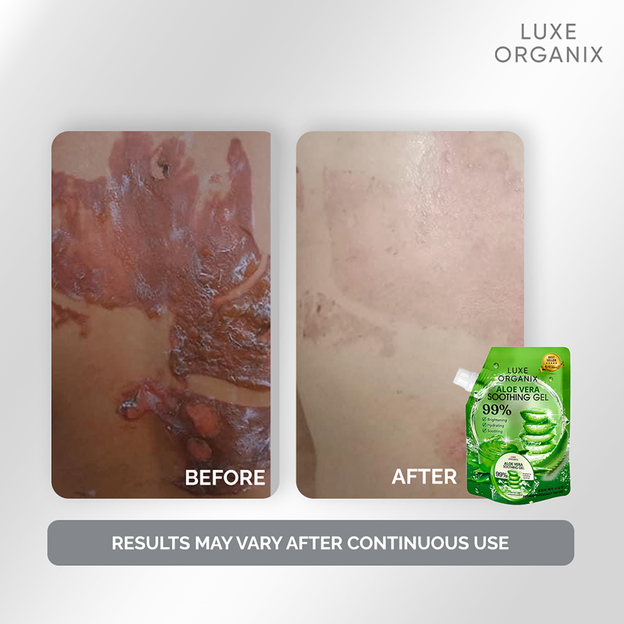 Luxe Organix Aloe Vera Soothing Gel - 100ml