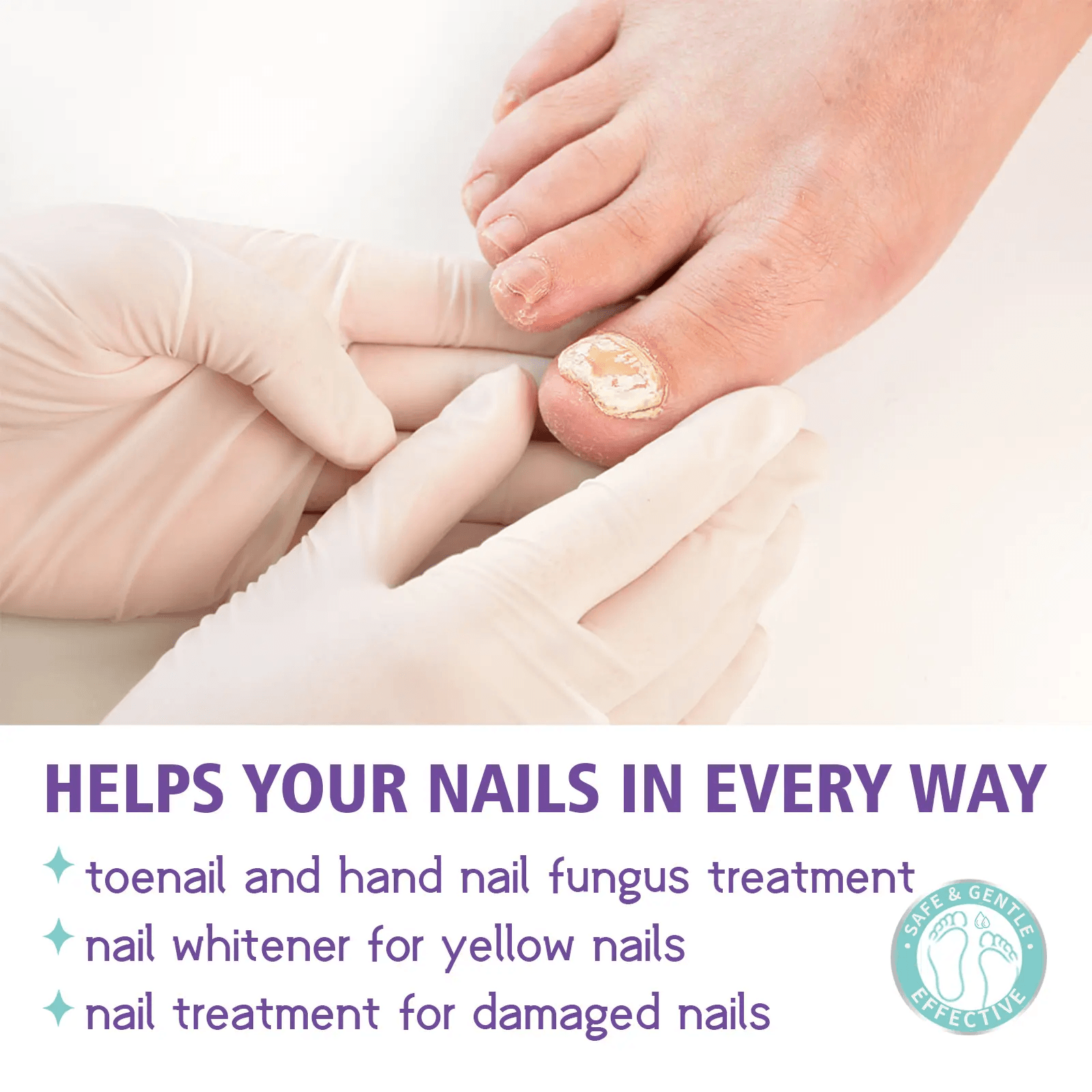 Jaysuing Nail Fungus Spray - 100ml