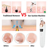 Rechargeable Facial Pore Cleaner Kit