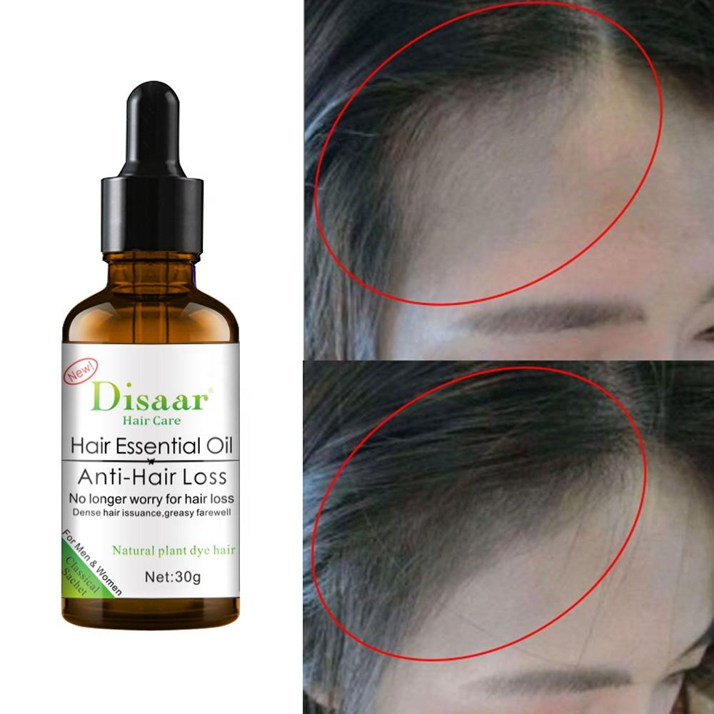 Disaar Anti-Hair Loss Shampoo + Oil - 200ml + 30g