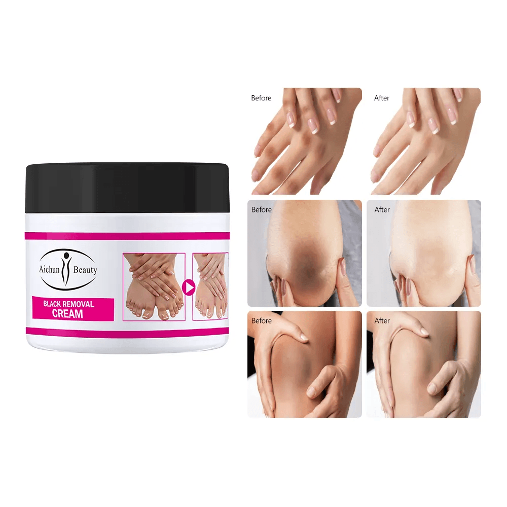 Aichun Beauty Black Removal Whitening Cream - 50g