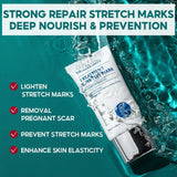 Vibrant Glamour Stretch Marks Remover Cream - 30g