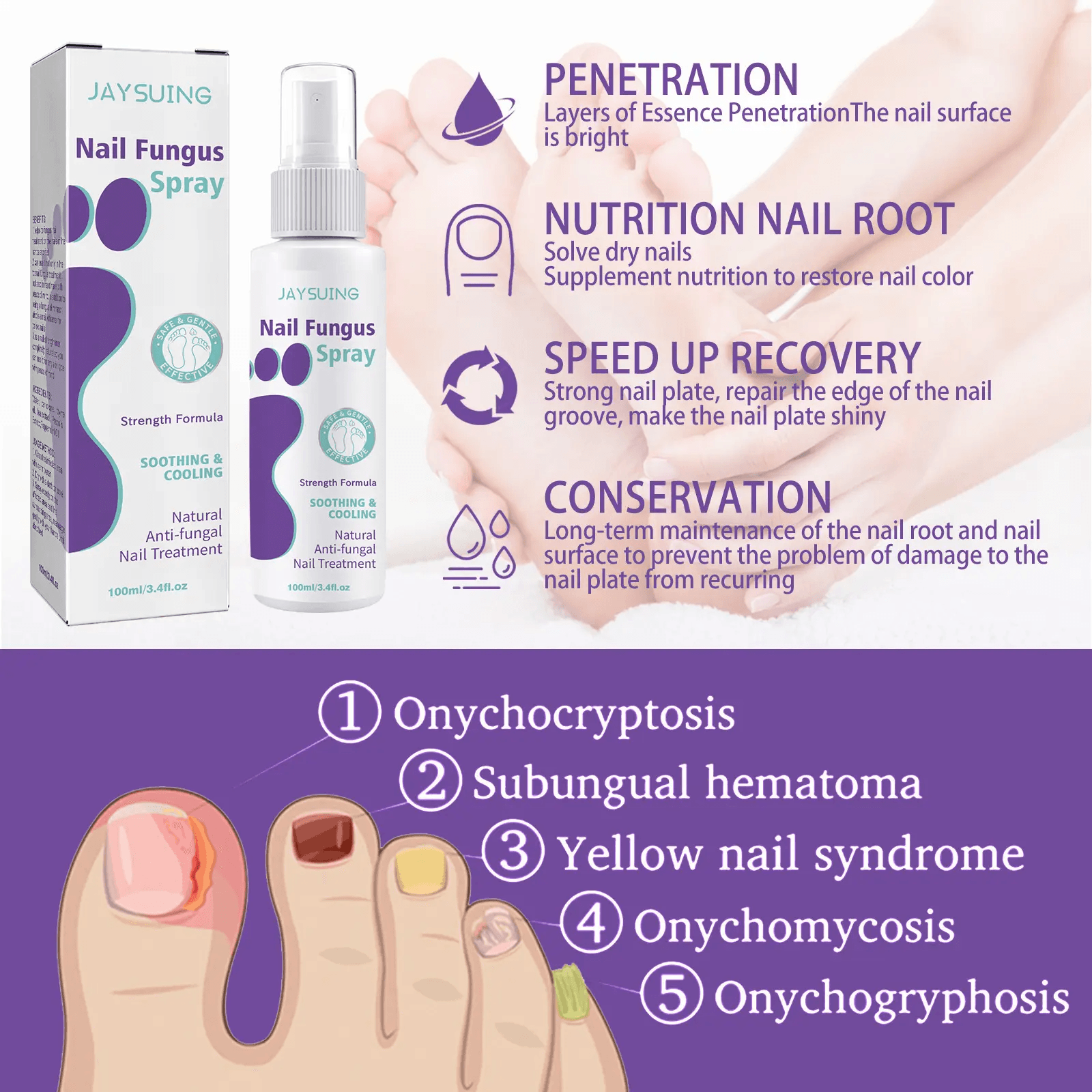 Jaysuing Nail Fungus Spray - 100ml