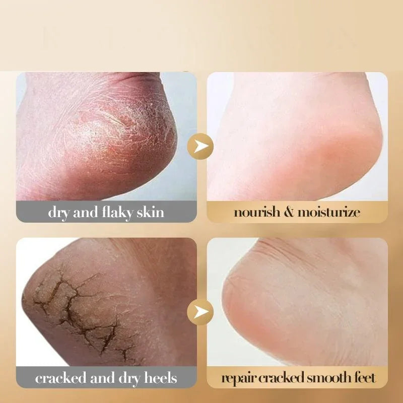 Sadoer Collagen Nourishing Anti Dry Cracking Foot Cream - 60g