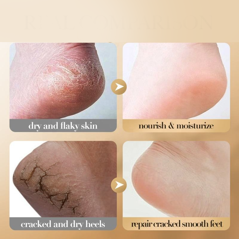 Sadoer Collagen Nourishing Anti Dry Cracking Foot Cream - 60g