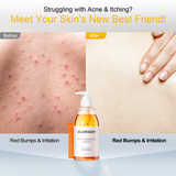 Quarxery Mite & Acne Cleansing Body Wash - 250ml