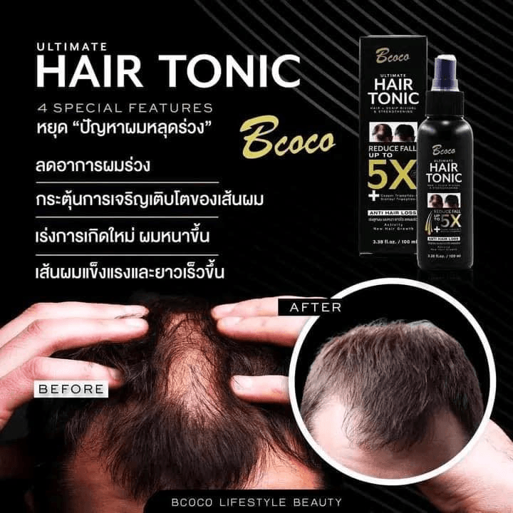 Bcoco Ultimate Hair Tonic Anti Hair Loss Thailand - 100ml