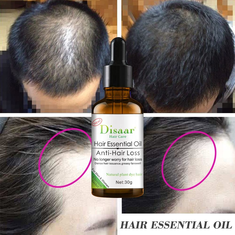 Disaar Anti-Hair Loss Shampoo + Oil - 200ml + 30g