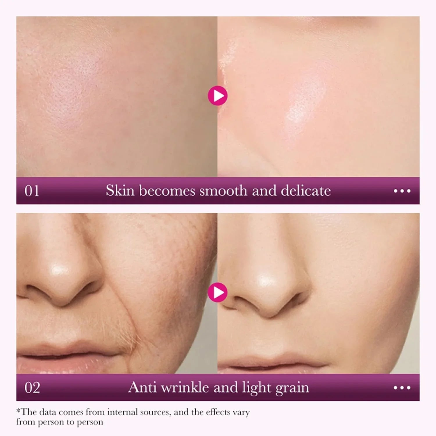 Sadoer Snail Reorganize Collagen Face Cream - 50g