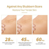Lanbena Skin Care Gel - 30g
