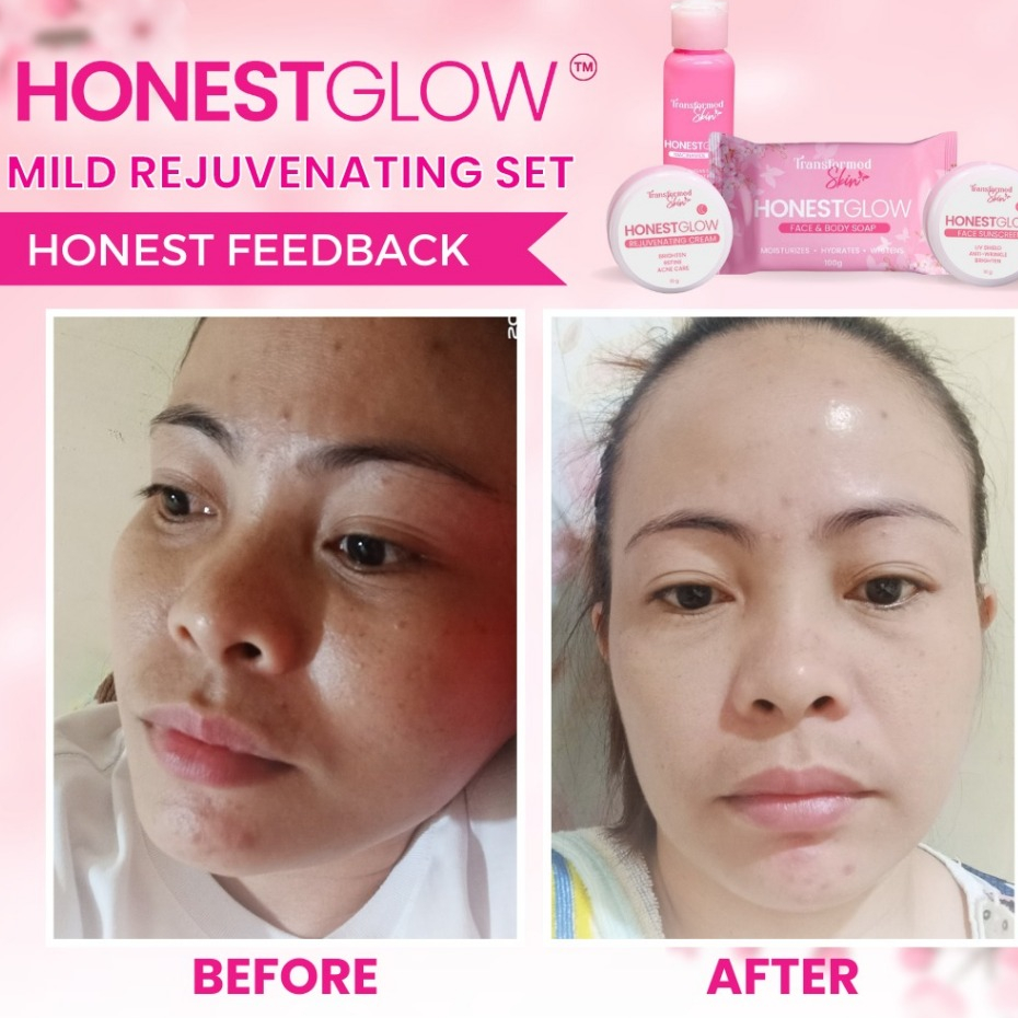 مجموعة HonestGlow للعناية بالوجه مجموعة تجديد البشرة اللطيفة