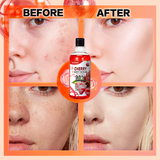 Dr.Meinaier 98% Intensive AHA Body Serum Cherry Extract - 500ml