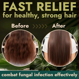 TWG Anti-Dandruff & Oil Control Tea Tree Shampoo - 800ml