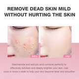 Skinever 3% Niacinamide Exfoliating Gel - 55ml