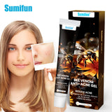 Sumifun Bee Venom Anti-Acne Gel - 20g