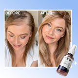 FEG Plus Hair Growth Spray Prevent Hair Loss - 50ml