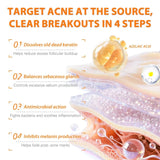 Skinoren Azelaic Acid 20% Anti-Acne Cream - 30g