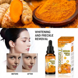 Kiss Beauty Turmeric with Vitamin C Face Serum - 30ml