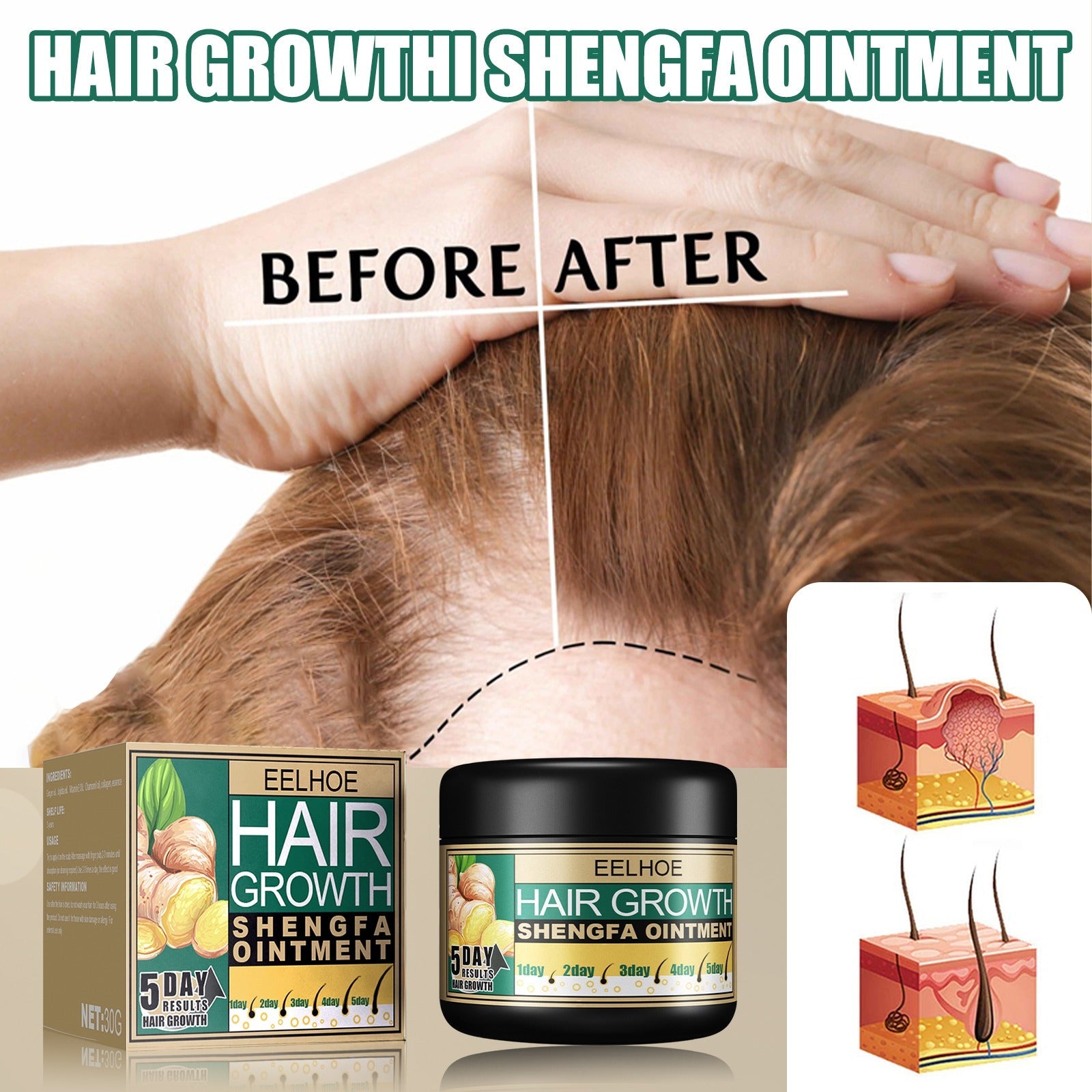 EELHOE Hair Growth Shengfa Cream - 100g