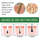 EELHOE Rosemary Water Prevent Hair Loss - 30ml