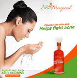 Skin & Magical Purifying and Acne Clearing Foaming Wash -100ml
