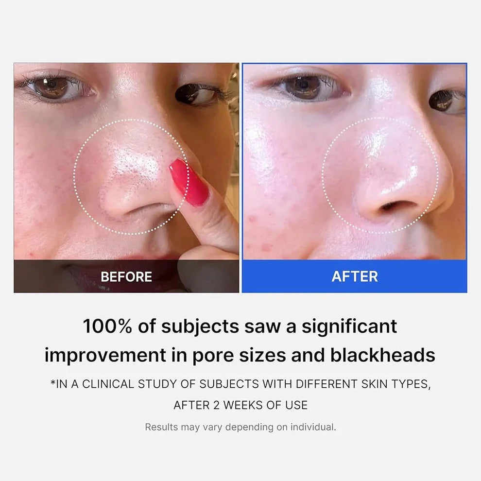 Medicube Zero Pore Cream 2.0 - 50ml