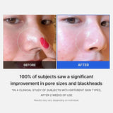 Medicube Zero Pore Cream 2.0 - 50ml