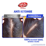 Lifebuoy Anti-Dandruff Shampoo - 680ml