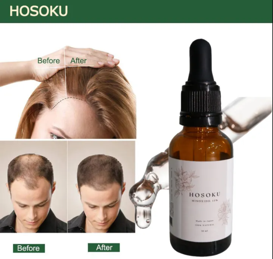 HOSOKU Minoxidil 15% Hair Regrowth Oil - 30ml