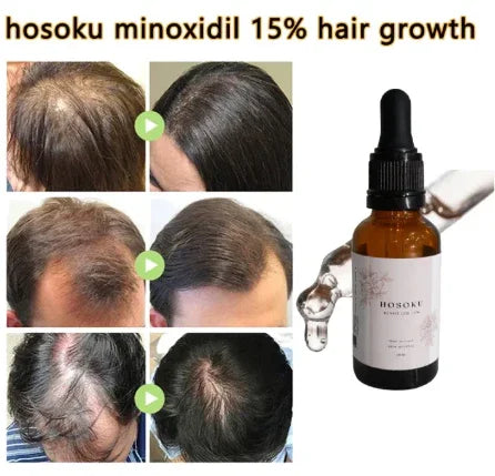 HOSOKU Minoxidil 15% Hair Regrowth Oil - 30ml