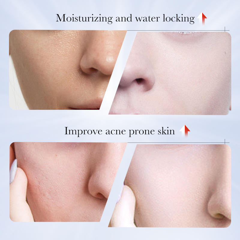 Sadoer Kojic Acid Niacinamide Brightening Hand Cream - 30g