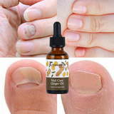 Guanjing Nail Care Ginger Oil Improve Damaged Nails - 30ml