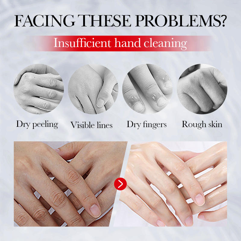 Sadoer Kojic Acid Niacinamide Brightening Hand Cream - 30g