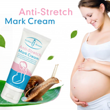 Aichun Beauty Anti-Stretch Mark Cream - 60g