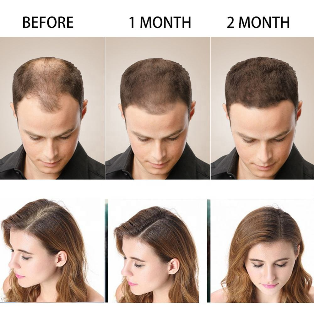 Disaar Anti-Hair Loss Shampoo + Oil - 200ml + 30g